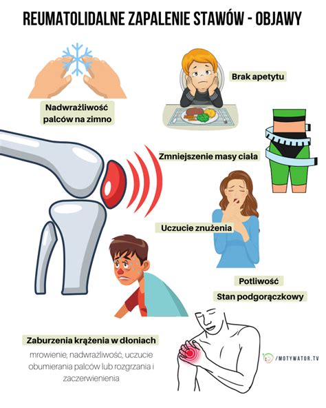 Wszystko co trzeba wiedzieć o reumatoidalnym zapaleniu stawów