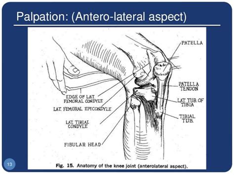 Palpation Antero Lateral Aspect 13 Knee Joint Anatomy Of The Knee