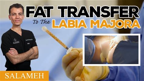 Labia Plastic Surgery Salameh Plastic Surgery Genitoplasty