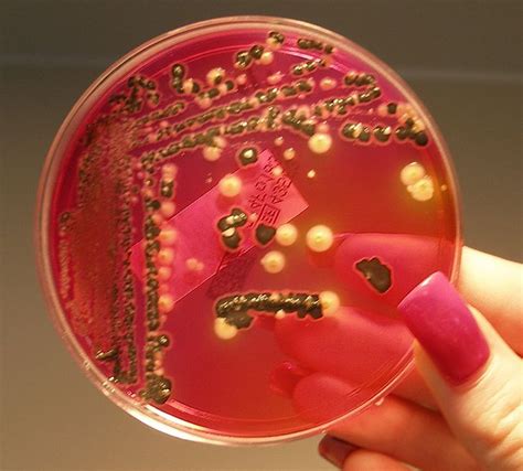 Salmonellae Growing On Xld Agar Medical Laboratories