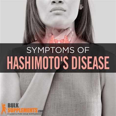 Hashimotos Disease Symptoms Causes And Treatment By James Denlinger
