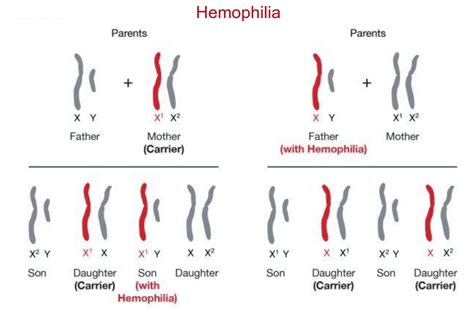 When a recessive trait is on the x chromosome: Sex-Linked Traits and Disorders