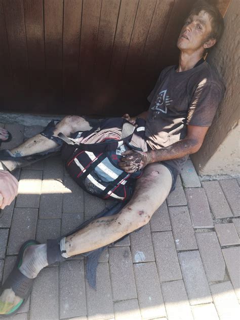 Suspected Cable Thief Critical After Electrocution Sedibeng Ster