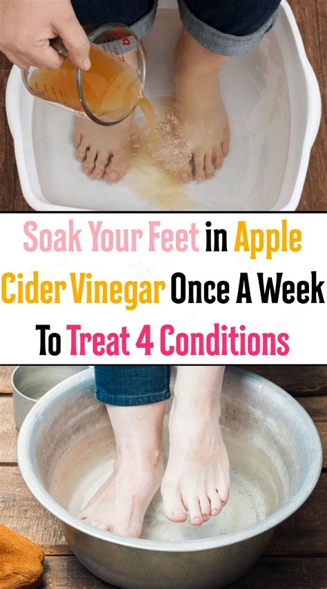 Soak Your Feet In Apple Cider Vinegar Once A Week To Treat 4 Conditions