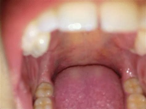 Uvula Breath Teeth Tongue A Dip In My Mouth Bambola Genuina Clips4sale