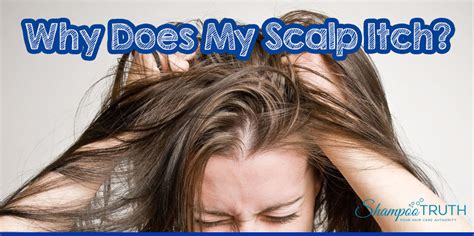 Why Does My Scalp Itch There Are Countless Reasons Why Your Scalp May Be Itching Let’s Start