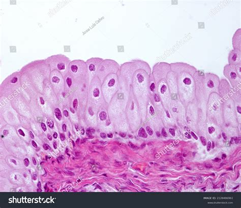 Transitional Epithelium Urothelium Exclusive Urinary Tract Stock Photo