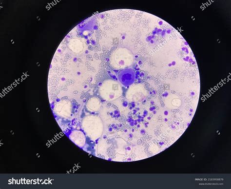 Megakaryocyte Large Bone Marrow Cell Stock Photo 2183958879 Shutterstock