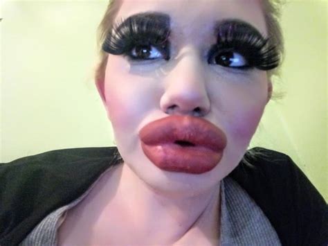 Lip Injections Lip Plumper Longer Eyelashes Fake Eyelashes Botox Big Lips Natural Pout