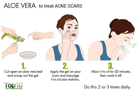 How To Get Rid Of Acne Scars Top 10 Home Remedies
