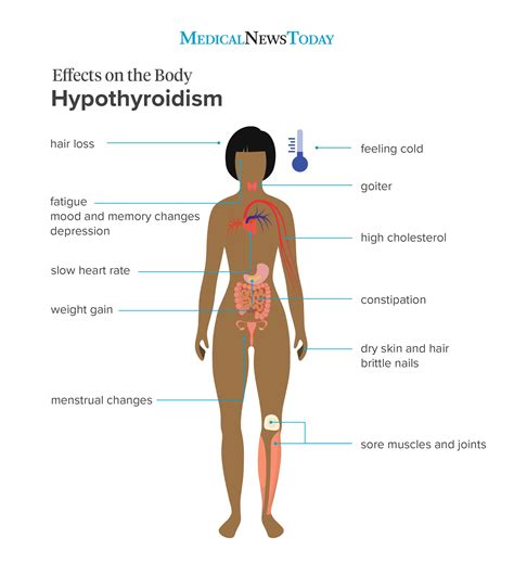 Hypothyroidism Symptoms Signs To Look Out For