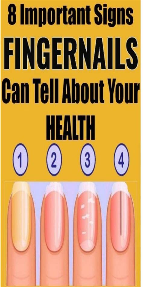 8 Important Signs Your Fingernails Can Tell About Your Health