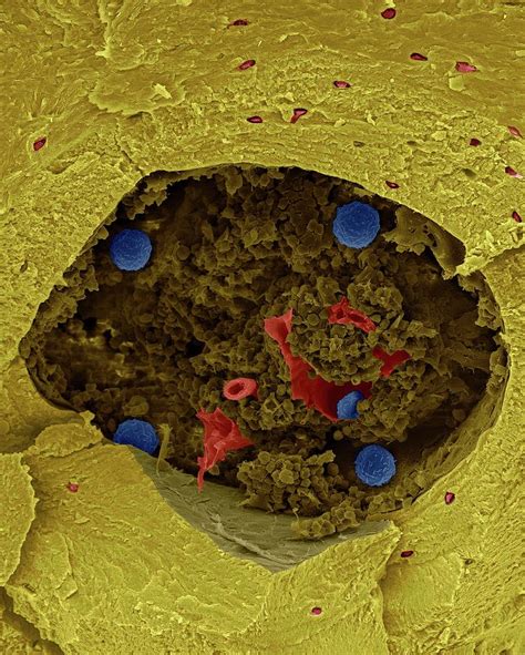 Human Stem Cells In Bone Marrow Cavity Photograph By Dennis Kunkel