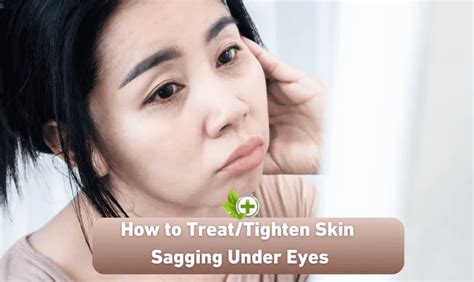 How To Treattighten Skin Sagging Under Eyes Ulti Health Guide