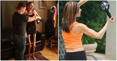 This Actress Suffered From Deadly Anorexia And Her Transformation Will Leave You Speechless