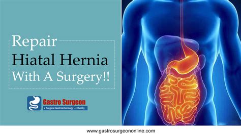 Pin On Gastro And Bariatric Surgeon In Chennai