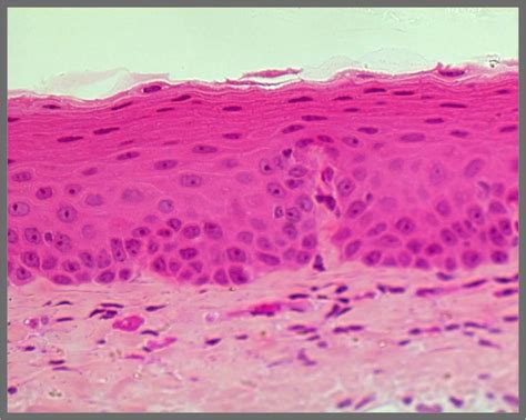 Exam I Histology Bs01502 With Gurney At Logan College Of