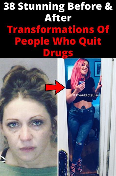 38 Stunning Before After Transformations Of People Who Quit Drugs Artofit
