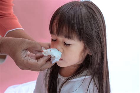What Causes Epistaxis How To Treat Your Childs Nosebleed At Home