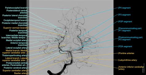 Arteries Of Brain Angiography Normal Anatomy E Anatomy