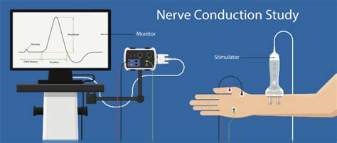 Electromyography Emg Nerve Conduction Study Ncs Scanlab Center