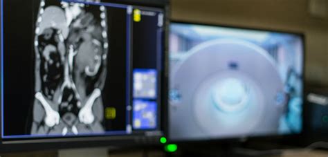 Diagnosing Cancer With An Abdomen Ct Scan American Health Imaging