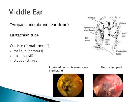 Ppt Ear Otic Powerpoint Presentation Free Download Id2185156