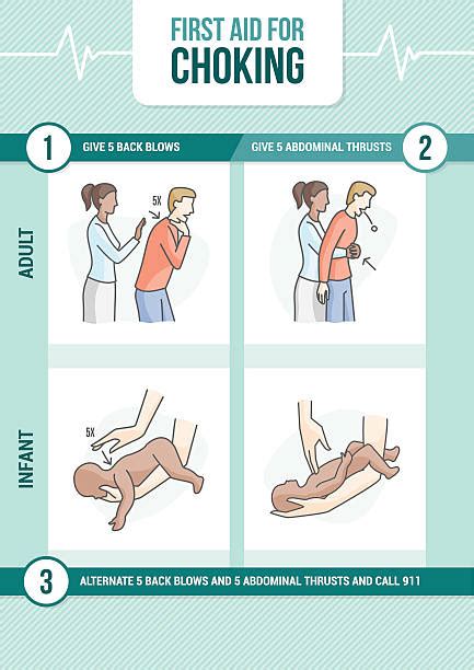 Choking First Aid Illustrations Royalty Free Vector Graphics And Clip