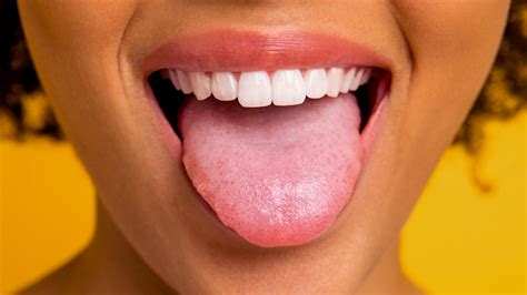 can geographic tongue affect lips and teeth
