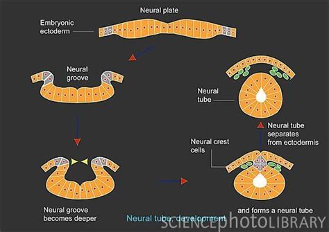 Excellent Depiction Of Stages Of Neural Tube Development Neural Tube