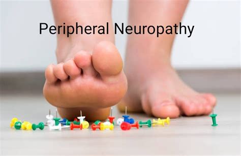 Peripheral Neuropathy Type Causessymptomsrisk Factorsprevention