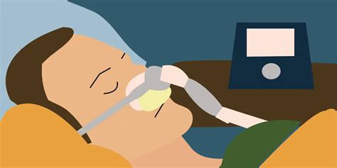 obstructive sleep apnea — everything you need to know