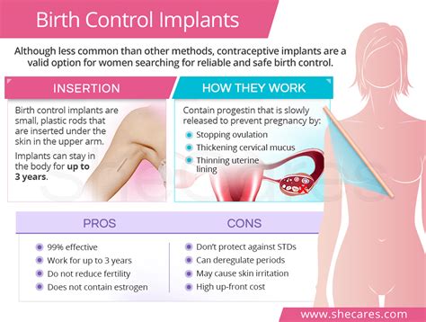 Implant Contraception