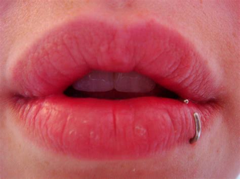 And depending on where you live, bed bugs might be in. Swollen lip.. | Flickr - Photo Sharing!