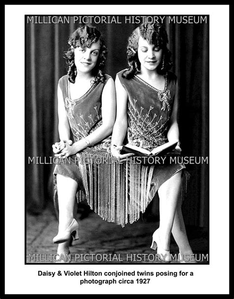 Daisy And Violet Hilton Conjoined Twins Posing For A Photograph Circa 1927 Millican Pictorial