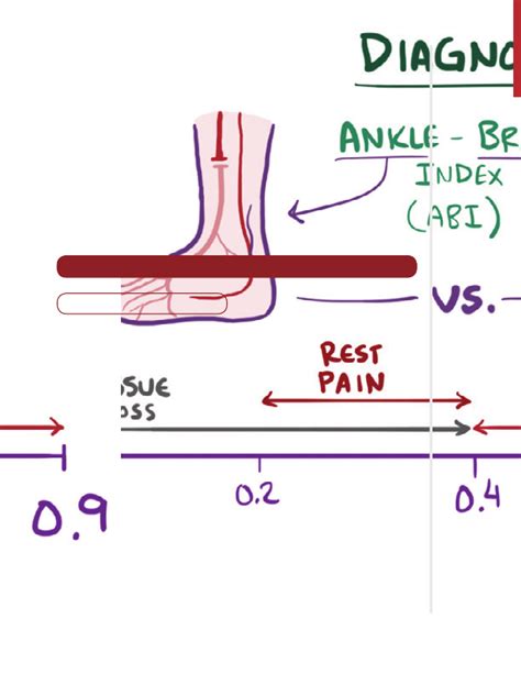 Peripheral Artery Disease Notes Diagrams Illustrations Osmosis