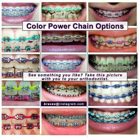 As per my knowledge, (working in a dental office that also does orthodontics) the power chain is not an actual type of braces, rather it is something that goes across the braces and a general step in the process of aligning. Color Power chains | Braces tips, Cute braces, Braces colors