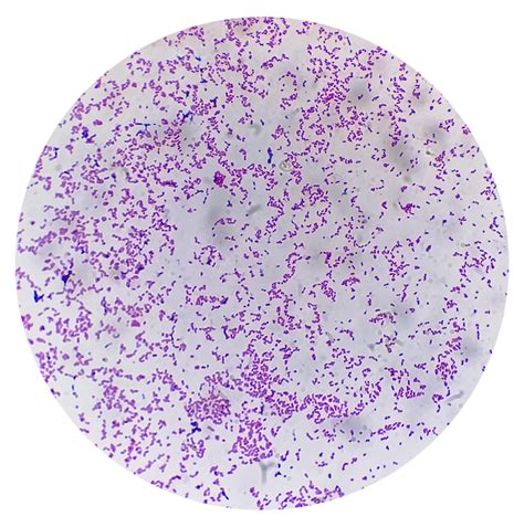 Premium Photo Gram Staining Also Known As Grams Method Is A Method