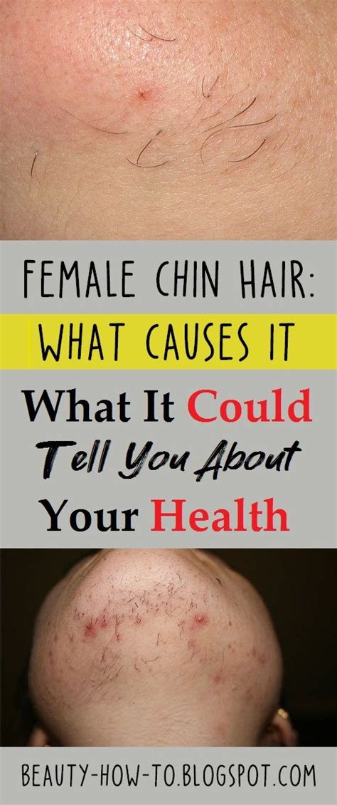 Female Chin Hair What Causes It And What It Could Tell You About Your