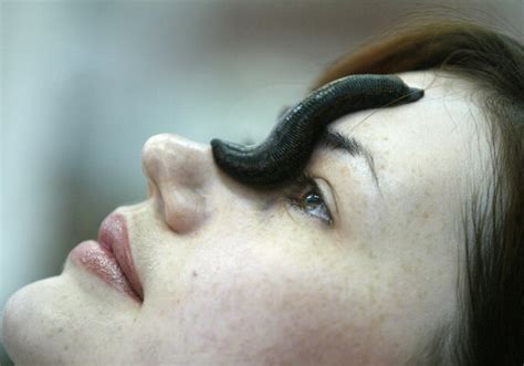 Would You Put Leeches On Your Face In The Name Of Beauty The Wacky New