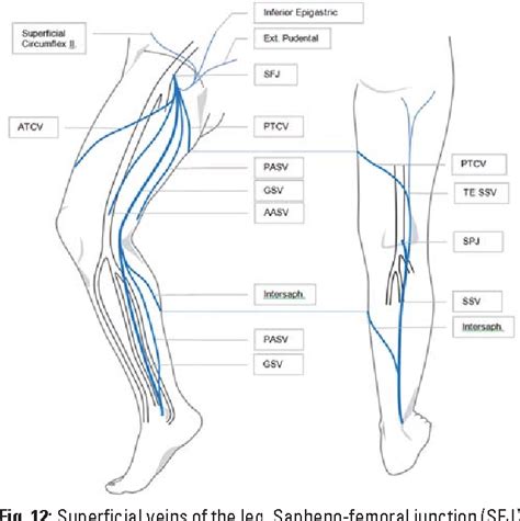 Duplex Ultrasound In The Assessment Of Lower Extremity Venous Insufficiency Semantic Scholar