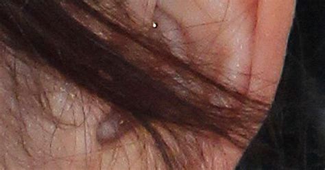 Penelope Cruz Sports Acupuncture Pins In Her Inner Ear Pics Huffpost Uk