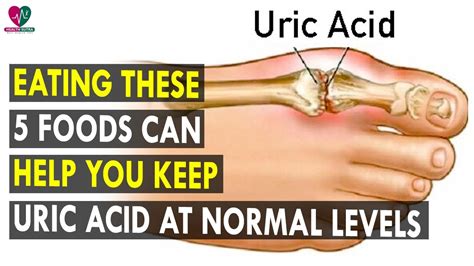 Eating These 5 Foods Can Help You Keep Uric Acid At Normal Levels