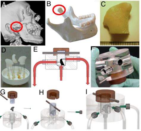 Tissue Engineering Of Anatomically Shaped Bone Grafts Using 3d Flow