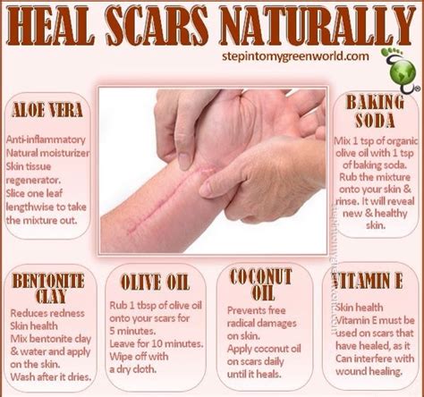 Heal Scars Naturally Musely