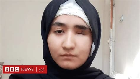 خودکش حملے میں اپنی ایک آنکھ کھونے والی افغان طالبہ نے یونیورسٹی کے داخلے کا امتحان پاس کر لیا