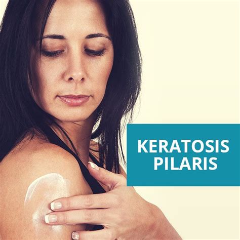 How To Get Rid Of Keratosis Pilaris Skincare Tips Blog By Zenmed