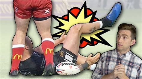 Doctor Explains Wild Rugby Knee Dislocation Slapped Back Into Place Youtube