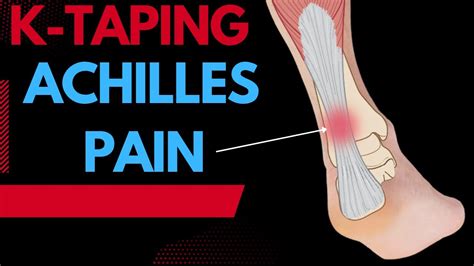 How To Treat Achilles Pain Tendonitis Using Kinesiology Taping