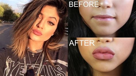 How To Get Kylie Jenner Lips Fuller Lips Candylipz Youtube